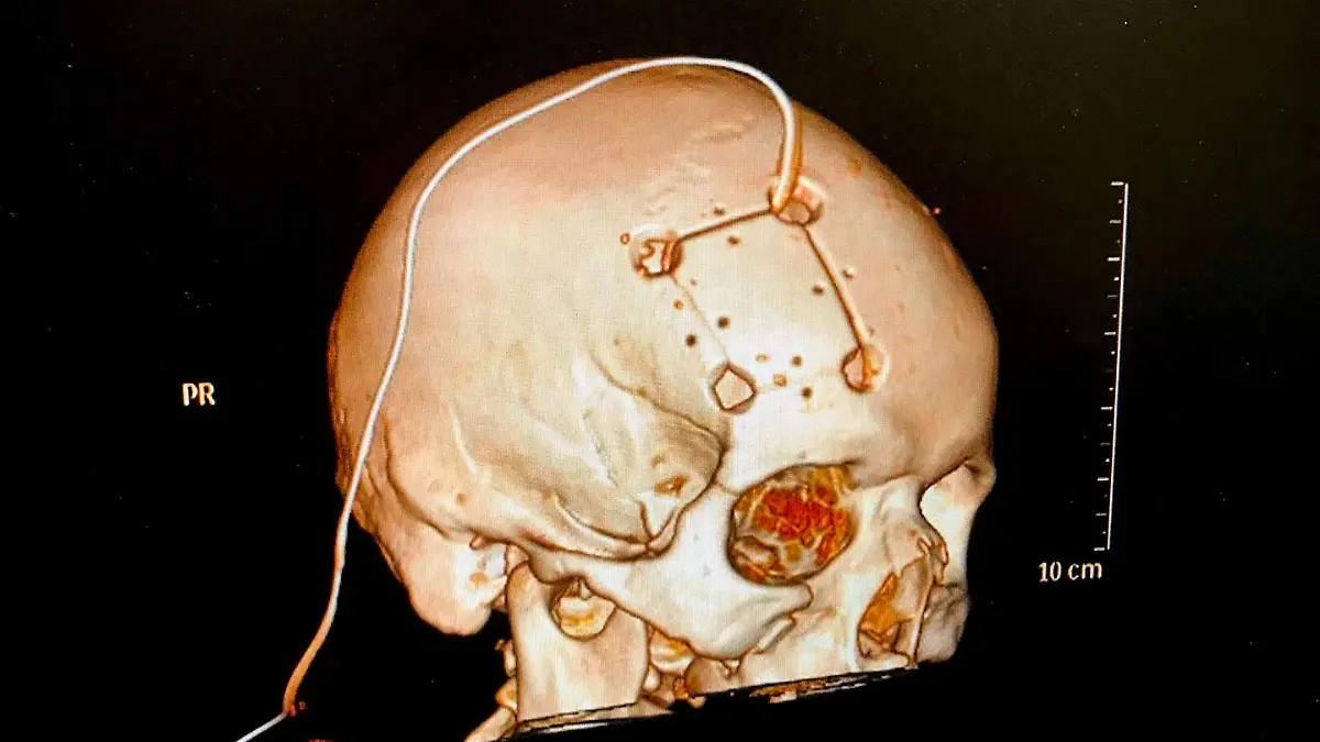 1A CEREBRO_CORTESIA RAINIERO DE LA VEGA